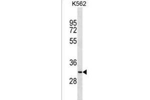 SYCE1L Antibody (C-term) (ABIN1536838 and ABIN2838126) western blot analysis in K562 cell line lysates (35 μg/lane). (SYCE1L Antikörper  (C-Term))