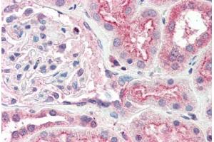 Human Kidney (formalin-fixed, paraffin-embedded) stained with OGG1 antibody ABIN337126 at 2. (OGG1 Antikörper  (AA 282-297))