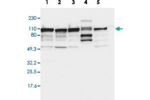 Western blot analysis of Lane 1: RT-4, Lane 2: U-251 MG, Lane 3: A-431, Lane 4: Liver, Lane 5: Tonsil with CTAGE5 polyclonal antibody . (MIA2 Antikörper  (AA 392-507))