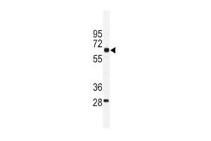 Western blot analysis of PKM1 antibody (C-term ) (ABIN391688 and ABIN2841593) in mouse testis tissue lysates (35 μg/lane). (PKM1 (AA 383-417), (C-Term) Antikörper)