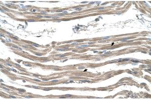 Human Muscle (SLC25A22 Antikörper  (N-Term))