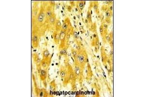 Immunohistochemistry (Paraffin-embedded Sections) (IHC (p)) image for anti-CD36 (CD36) (AA 213-242) antibody (ABIN389411)