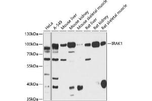Western blot analysis of extracts of various cell lines, using IR antibody (ABIN6130497, ABIN6142514, ABIN6142515 and ABIN6216327) at 1:3000 dilution. (IRAK1 Antikörper  (AA 424-633))