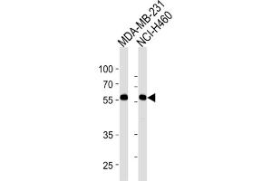 Western Blotting (WB) image for anti-Raftlin, Lipid Raft Linker 1 (RFTN1) antibody (ABIN3004469) (RFTN1 Antikörper)