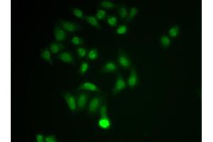 Immunofluorescence analysis of MCF-7 cell using CHAT antibody. (Choline Acetyltransferase Antikörper  (AA 331-630))