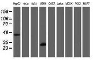 Image no. 2 for anti-Mitochondrial Translational Initiation Factor 3 (MTIF3) (AA 56-278) antibody (ABIN1491593) (MTIF3 Antikörper  (AA 56-278))