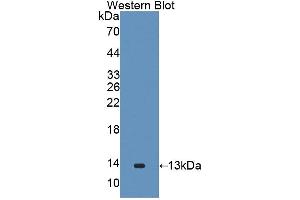Western blot analysis of the recombinant protein. (GALP Antikörper  (AA 29-115))