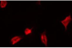 ABIN6267537 staining Hela by IF/ICC. (YAP1 Antikörper  (pSer127))