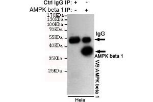 Immunoprecipitation analysis of Hela cell lysates using PK beta 1 mouse mAb. (PRKAB1 Antikörper)