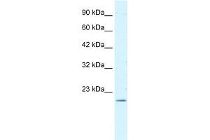 WB Suggested Antibody Titration:  0. (FOXP2 Antikörper  (N-Term))