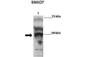 WB Suggested Anti-SMAD7 Antibody    Positive Control:  Lane 1: 2ug Flag-SMAD7 transfected 293 extracts   Primary Antibody Dilution :   1:500  Secondary Antibody :  Goat anti-rabbit-HRP   Secondry Antibody Dilution :   1:5000  Submitted by:  Anonymous (SMAD7 Antikörper  (N-Term))