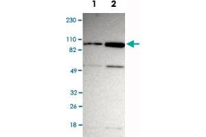 Western Blot analysis of Lane 1: RT-4 and Lane 2: U-251MG sp cell lysates with ZNF267 polyclonal antibody . (ZNF267 Antikörper)