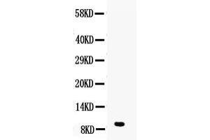 Western blot analysis of DBI using anti-DBI antibody . (Diazepam Binding Inhibitor Antikörper  (AA 2-87))