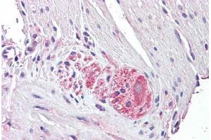 Anti-NTN4 / Netrin 4 antibody IHC staining of human small intestine, myenteric plexus.