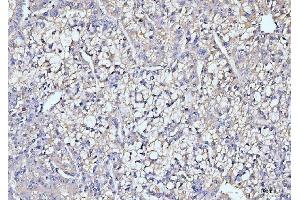 IHC analysis of ITCH/AIP4 using anti-ITCH/AIP4 antibody (ABIN7600263). (ITCH Antikörper  (AA 17-358))
