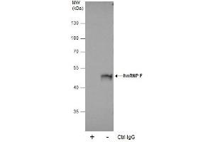 IP Image Immunoprecipitation of hnRNP F protein from 293T whole cell extracts using 5 μg of hnRNP F antibody [N1N3], Western blot analysis was performed using hnRNP F antibody [N1N3], EasyBlot anti-Rabbit IgG  was used as a secondary reagent. (HNRNPF Antikörper)