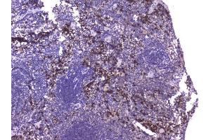 IHC analysis of CCL8 using anti-CCL8 antibody (ABIN6719605).