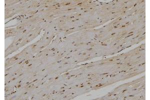 ABIN6276978 at 1/100 staining Rat heart tissue by IHC-P.