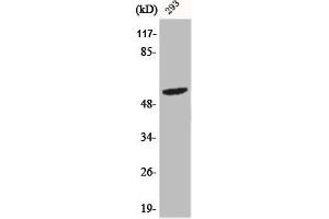 Western Blot analysis of 293 cells using Phospho-Shb (Y246) Polyclonal Antibody (SHB Antikörper  (pTyr246))