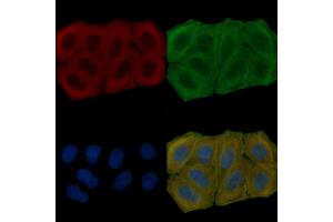 ABIN6265789 and ABIN6278090 staining Hela cells(30 min of UV treatment) by IF/ICC.