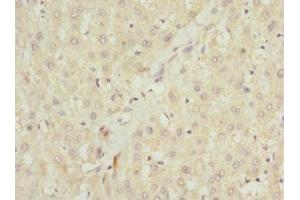 Immunohistochemistry of paraffin-embedded human liver tissue using ABIN7151087 at dilution of 1:100 (NHLRC1 Antikörper  (AA 1-280))