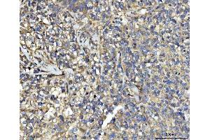 IHC analysis of UBA5 using anti-UBA5 antibody (ABIN7601503). (UBA5 Antikörper  (AA 37-389))