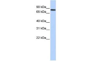 Western Blotting (WB) image for anti-Adenosine Deaminase, RNA-Specific, B2 (ADARB2) antibody (ABIN2458539)