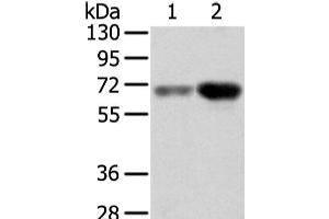 Western Blot analysis of Human lung cancer and placenta tissue using TBL1X Polyclonal Antibody at dilution of 1/500 (TBL1X Antikörper)