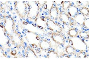 Immunohistochemistry of paraffin-embedded Mouse kidney using RNF149 Polyclonal Antibody at dilution of 1:100 (40x lens). (RNF149 Antikörper)