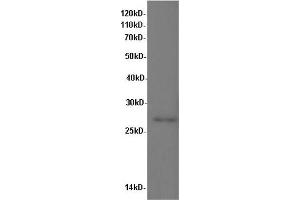 Western Blot analysis of Rat kidney tissue using IL10 Polyclonal Antibody at dilution of 1:600 (IL-10 Antikörper)