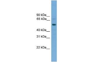 WB Suggested Anti-SKIL  Antibody Titration: 0. (SKIL Antikörper  (Middle Region))
