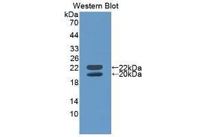 Western blot analysis of the recombinant protein. (IGFBP3 Antikörper  (AA 140-271))