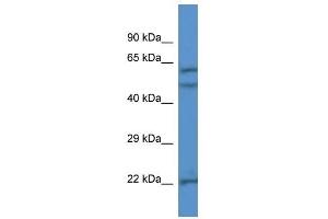 Western Blot showing HPSE antibody used at a concentration of 1 ug/ml against Jurkat Cell Lysate (HPSE Antikörper  (N-Term))