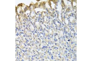 Immunohistochemistry of paraffin-embedded mouse stomach using TUBB8 antibody. (Tubulin, beta 8 Antikörper)