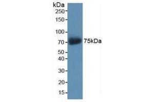 Western blot analysis of recombinant Human AKAP11. (AKAP11 Antikörper  (AA 1650-1901))