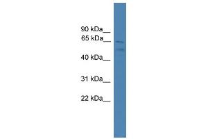 WB Suggested Anti-SPATA2 Antibody Titration: 0. (SPATA2 Antikörper  (C-Term))