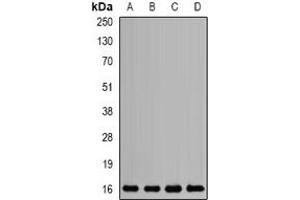 Western blot analysis of Mms2 expression in SKOV3 (A), HL60 (B), mouse liver (C), rat brain (D) whole cell lysates. (UBE2V2 Antikörper)