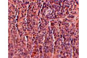Immunohistochemical staining of rat spleen tissue with 2. (ORAI3 Antikörper  (C-Term))