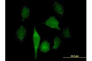 Immunofluorescence of purified MaxPab antibody to GNPAT on HeLa cell. (GNPAT Antikörper  (AA 1-680))