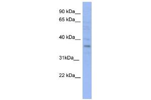 WB Suggested Anti-VTA1 Antibody Titration: 0. (VTA1 Antikörper  (N-Term))