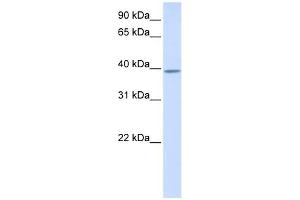 KLHDC2 antibody used at 1 ug/ml to detect target protein.