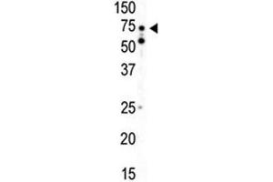 Western blot analysis of AMPK alpha 2 antibody and mouse heart tissue lysate
