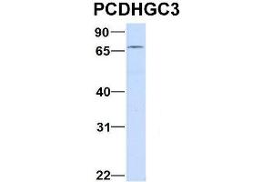 Host:  Rabbit  Target Name:  CHAD  Sample Type:  Human Adult Placenta  Antibody Dilution:  1. (Protocadherin gamma Subfamily C, 3 (PCDHGC3) (C-Term) Antikörper)