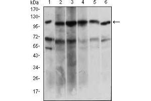 Western blot analysis using PAPLN mouse mAb against Hela (1), HepG2 (2), OCM-1 (3), Raji (4), Jurkat (5), NIH/3T3 (6) cell lysate. (PAPLN Antikörper  (AA 766-870))