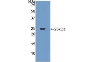 Detection of Recombinant CORO1A, Human using Polyclonal Antibody to Coronin 1A (CORO1A) (Coronin 1a Antikörper  (AA 7-204))