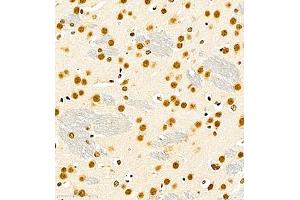 Immunohistochemistry (Paraffin-embedded Sections) (IHC (p)) image for anti-RNA Binding Motif Protein 45 (RBM45) antibody (ABIN7075477)