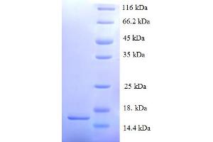 SDS-PAGE (SDS) image for Serum Amyloid A2 (SAA2) (AA 20-122) protein (His tag) (ABIN5710312) (SAA2 Protein (AA 20-122) (His tag))