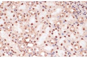 Immunohistochemistry (Paraffin-embedded Sections) (IHC (p)) image for anti-Catenin, beta (CATNB) (pSer33), (pSer37), (pThr41) antibody (ABIN7265240)