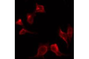 Immunofluorescence (fixed cells) (IF/ICC) image for anti-phospholipase C, gamma 1 (PLCG1) (pTyr771) antibody (ABIN6256799)
