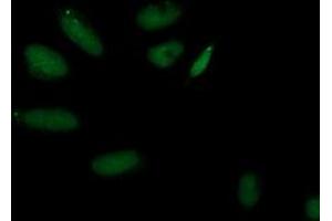 Immunofluorescent staining of HeLa cells using anti-AP2M1 mouse monoclonal antibody (ABIN2454660). (AP2M1 Antikörper  (AA 97-383))